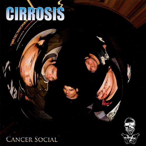 Cirrosis